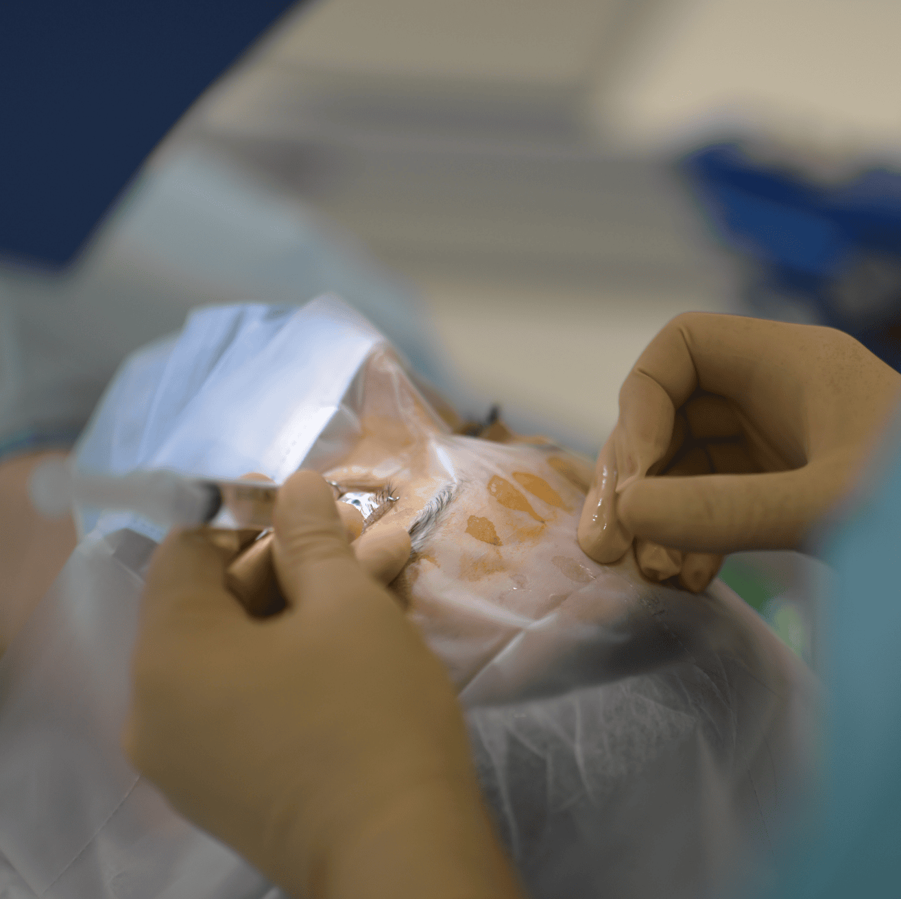 Clinique néovision lyon spécialiste en chirurgie réfractive